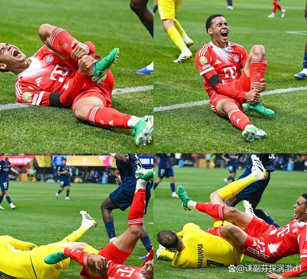 尤文图斯大将赛前受伤，球队战线或受影响的简单介绍